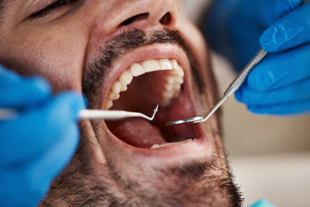 Best Emergency Root Canal Therapy in Kearney Park, MS