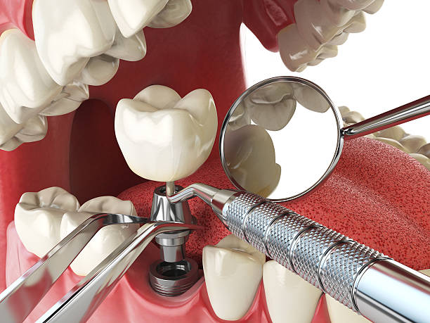 Best Emergency Pediatric Dental Care in Kearney Park, MS